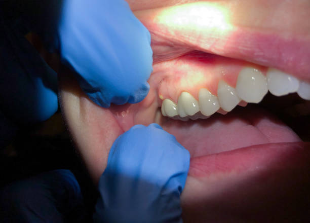 Best Pediatric Emergency Dentist in Industry, PA